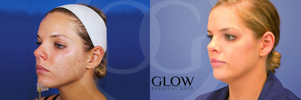 Laser treatments images West Bay Area