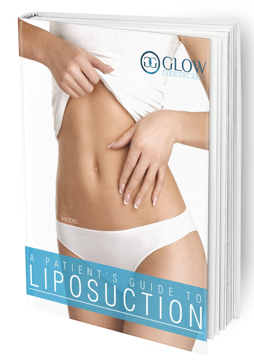 A Patient's Guide to Liposuction