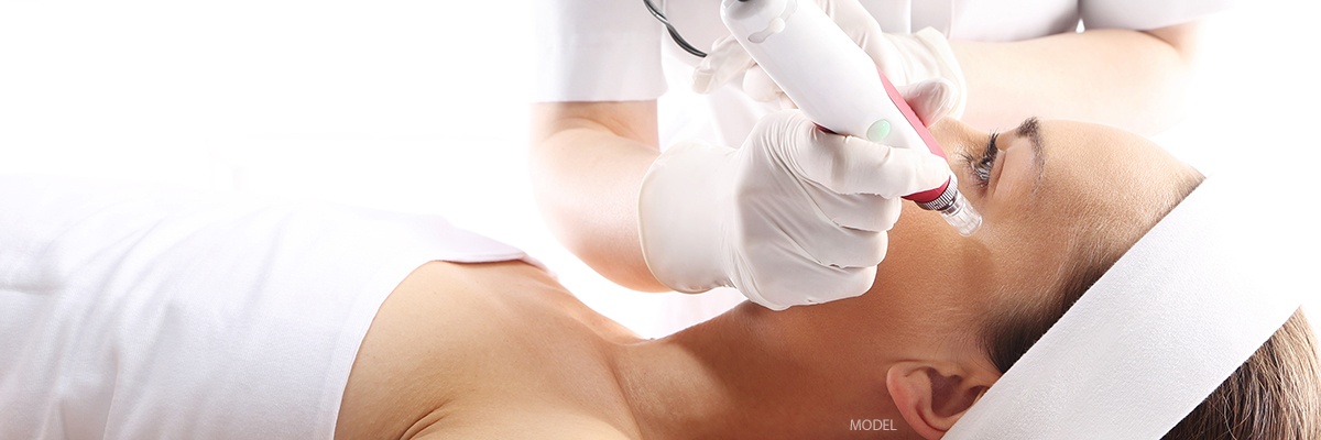 microneedling.jpg